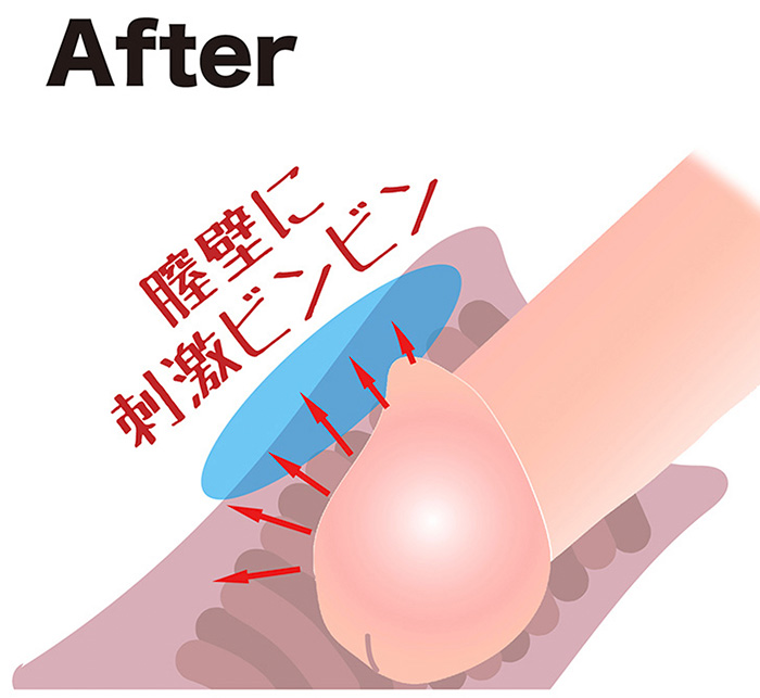 after 膣壁に刺激ビンビン 陰茎増大