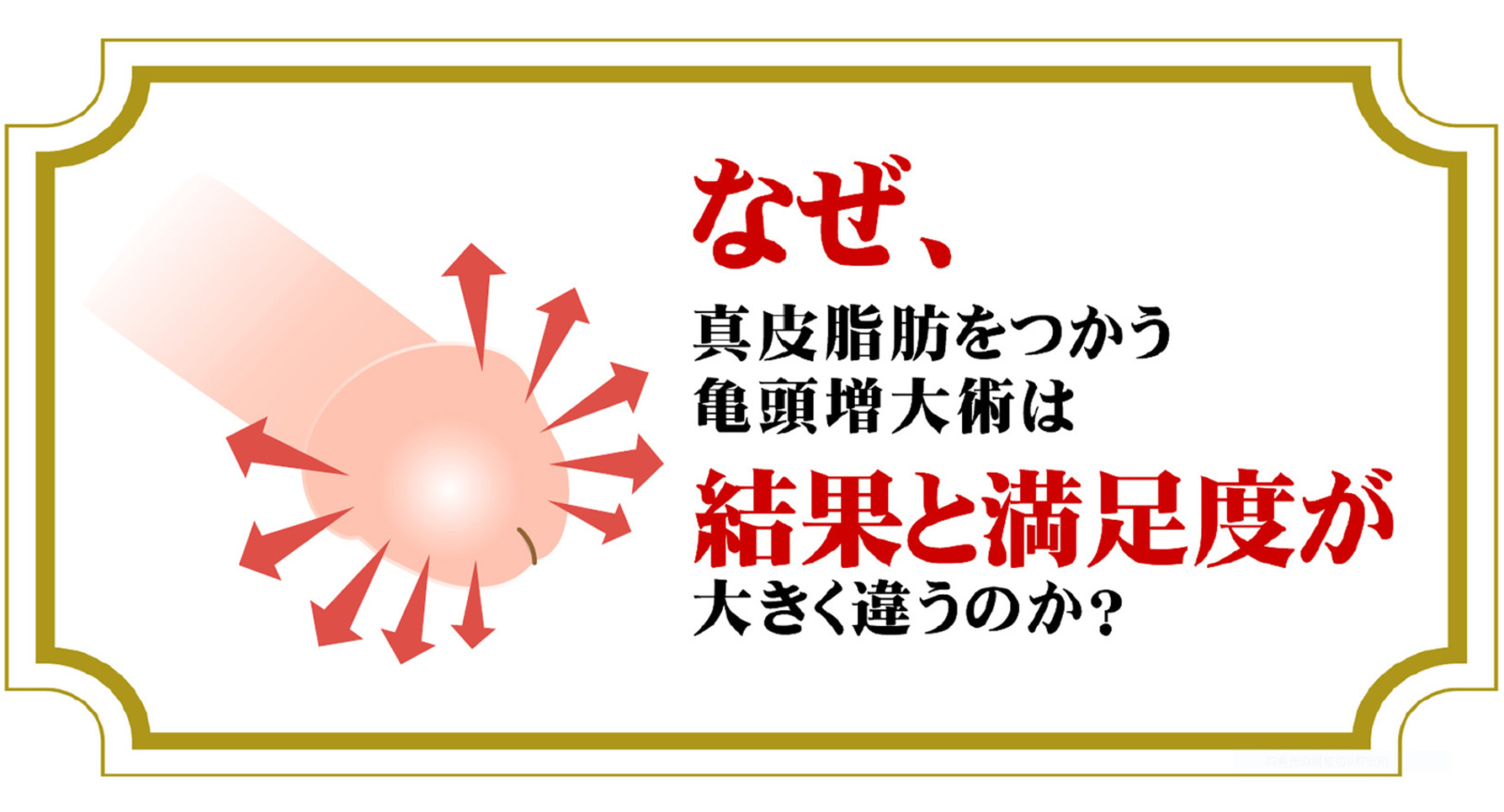 なぜ、真皮脂肪をつかう亀頭增大術は結果と満足度が大きく違うのか?
